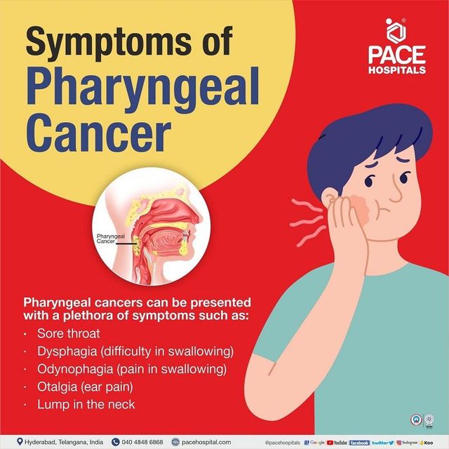 Early Throat Cancer Treatment